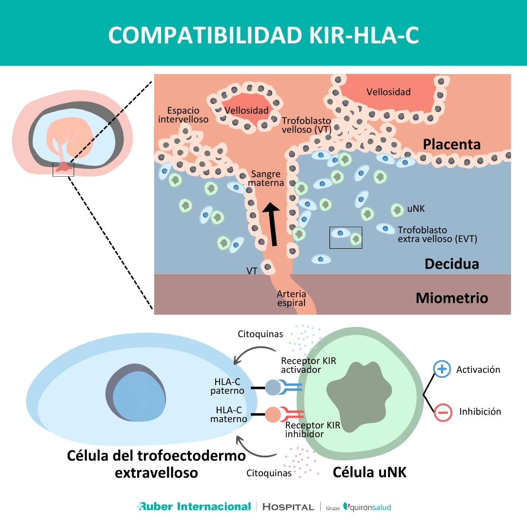 Compatibilidad KIR-HLAC madre embrion embarazo